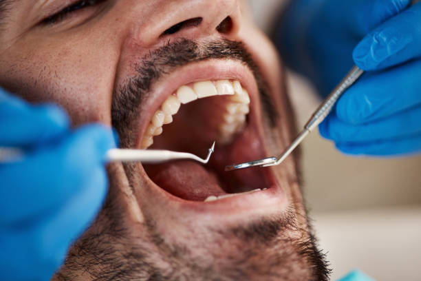 Best Broken or Cracked Tooth Emergency Dentist in Grandy, NC